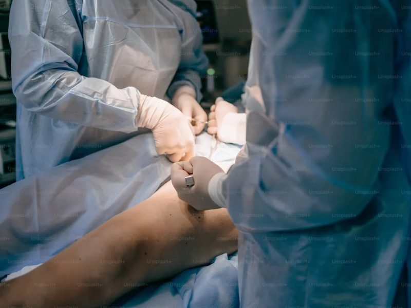 Uterine Fibroids treatment